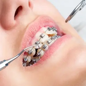 Orthodontic Services in Islamabad