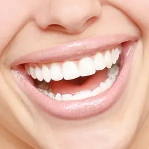 Tooth Whitening Services in Islamabad
