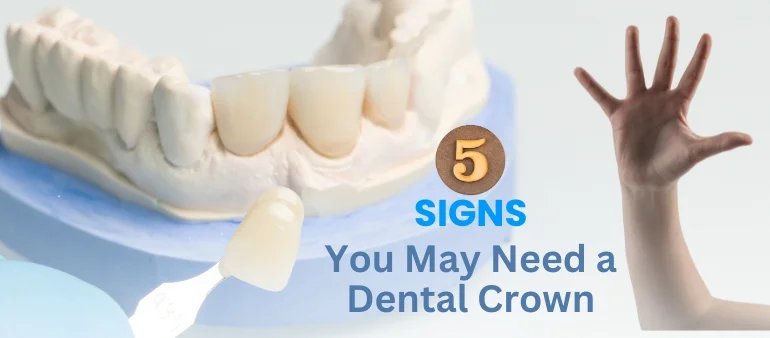 5 Signs You May Need a Dental Crown