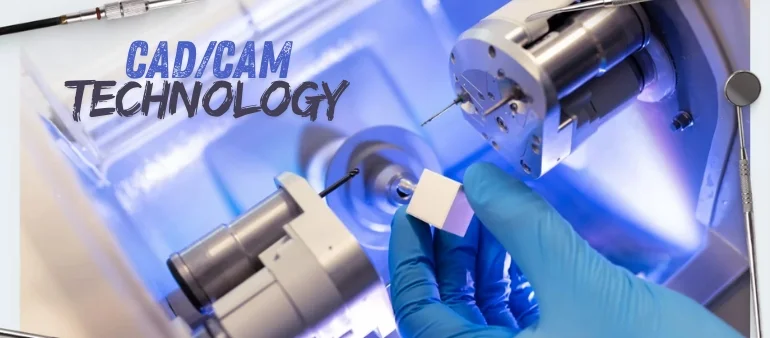 How CAD/CAM Technology is Transforming Dental Restorations