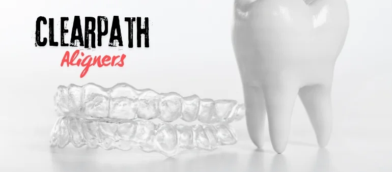 How Clear Path Aligners Can Transform Your Smile Without Braces