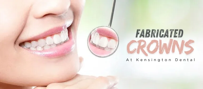 Replace Your Bridges and Dentures with Fabricated Crowns