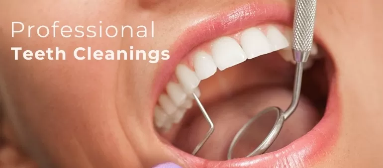 Dental Cleaning In Islamabad At Kensington Dental