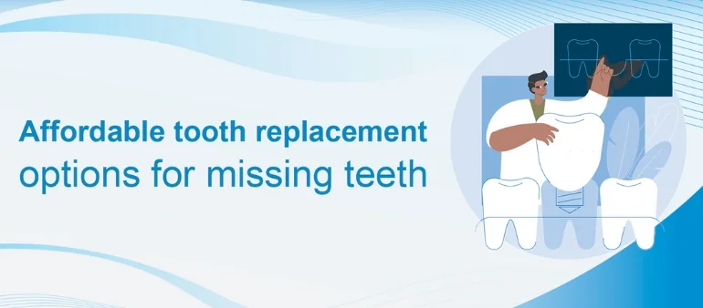 Tooth Replacement Options For You At Kensington Dental Islamabad