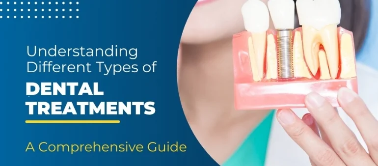 Ultimate Guide to Types of Dental Treatments