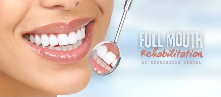 Understanding the Benefits of Full Mouth Rehabilitation